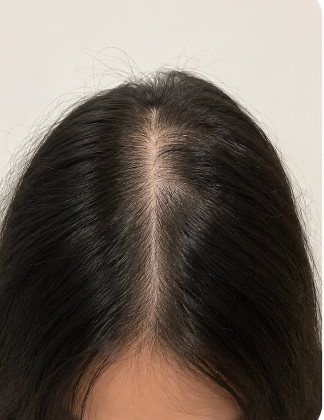 Before — Kumari Y.