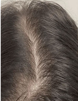 Before — Sangeetha