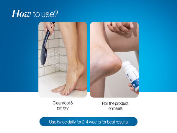 20% Urea Foot Roll On | 75 ml