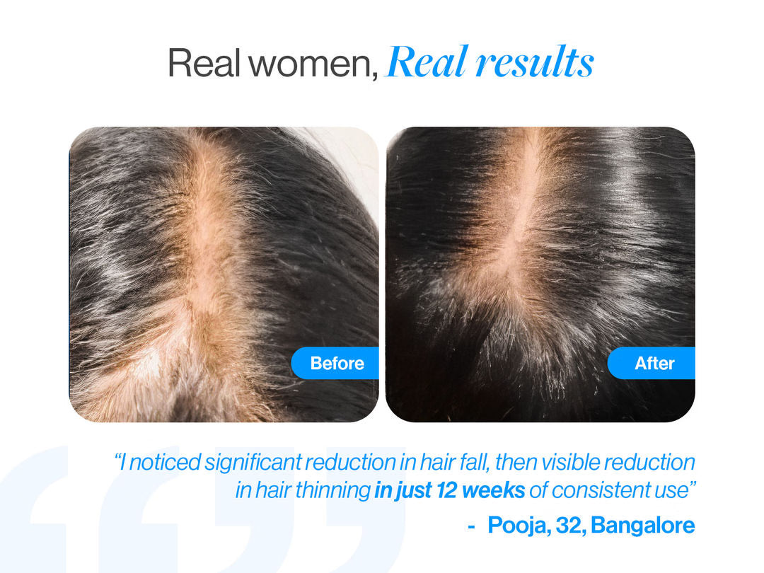 Advanced Hair Growth Pack with Roll On 25ml