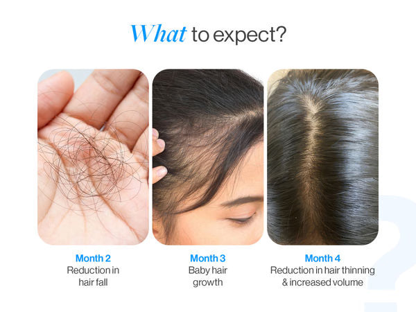 Advanced Hair Growth Serum Roll On - 3% Redensyl, 3% Rosemary (25 ml)