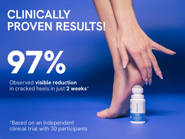 20% Urea Foot Roll On | 75 ml